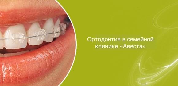 Ортодонтия в семейной стоматологии Авеста г. Подольск